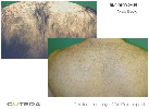 Male Back