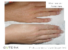 Hair - Hand
